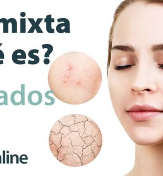 piel mixta