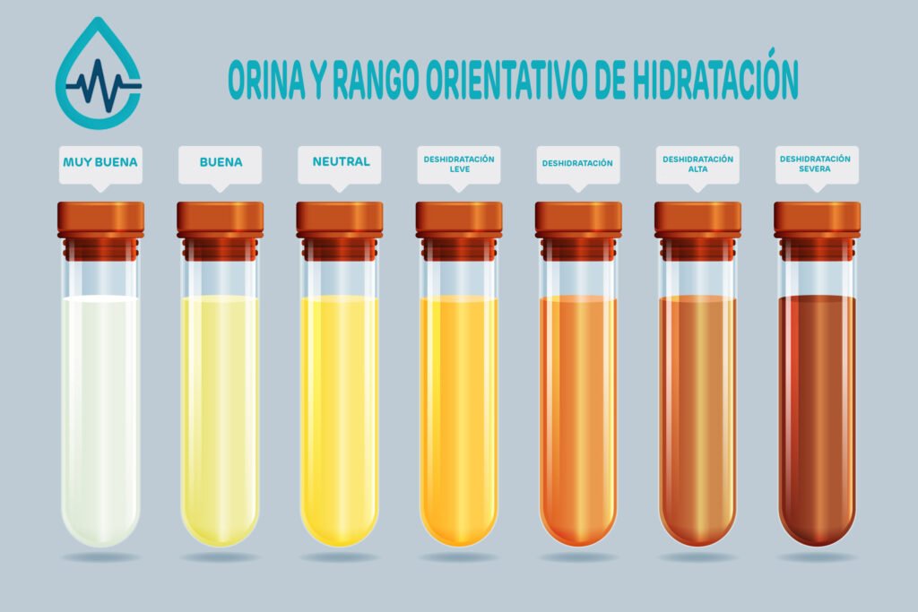 tabla de color de orina deshidratacion